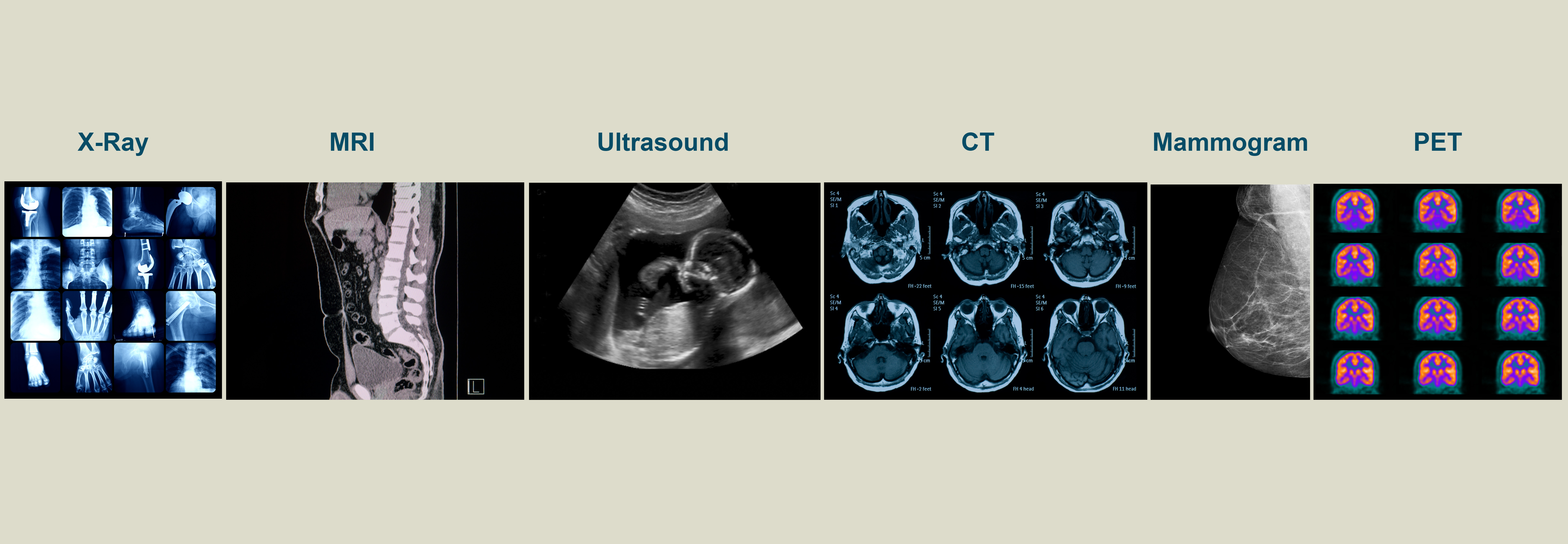 Illustrative Image shows examples of imaging scans. 