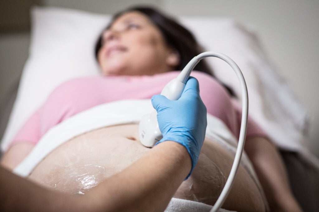 Photo of a pregnant woman getting a sonography