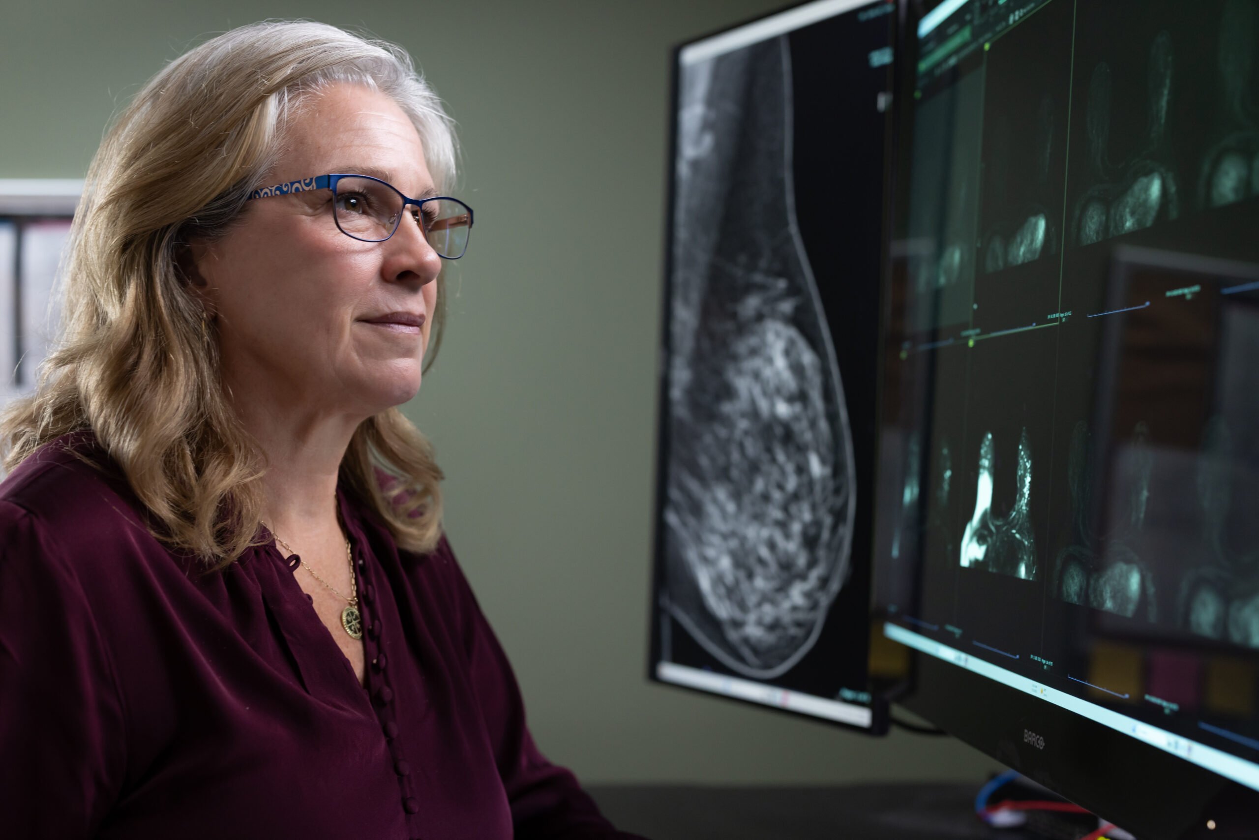 Photo of Dr. Kelly McAlarney viewing a mammogram at Women's Wellness and Breast Care
